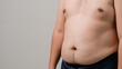 © ภาคภูมิ ปัจจังคะตา - Overweight or obese man on white background. Fat mens body measurements. he is dieting and losing weight. Healthcare, medicine concept. he is dieting and losing weight.