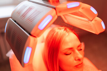 Closeup head of blonde female with closed eyes having LED red light hair photodynamic therapy during hair treatment in clinic. Young woman patient having non-invasive type of phototherapy.