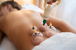 © Westend61 - Therapist applying vacuum cupping therapy on teenage girl's back in health spa