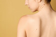 © New Africa - Woman with moles on her skin against beige background, back view. Space for text