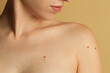 © New Africa - Woman with moles on her skin against beige background, closeup