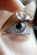 © Emanuel - Contact lens (eye and contact lens)