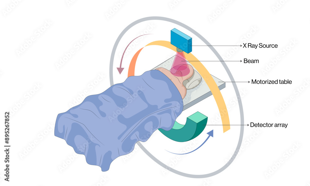 Ct Instrumentation Introduction Computed Tomography Scan Principle and Instrumentation Vector ...