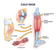 © VectorMine - Calf pain explanation with cramp from muscle contraction outline diagram, transparent background. Labeled educational scheme with leg anatomy and medical cause of sore rupture, strain.