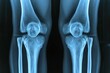 © Ifti Digital - This x-ray image shows a detailed view of a knee joint, providing insights into its structure and potential abnormalities, High resolution image of knees in X-ray, AI Generated