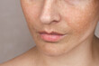 © Katyart - Close up caucasian woman's face with freckles or age spots. Age spots on the face