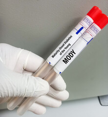 Poster - Oral swab sample for MODY or Maturity-Onset Diabetes of the Young test to diagnose neonatal diabetes (ND) in a symptomatic individual.