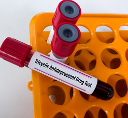 Poster - Blood sample for Tricyclic antidepressant (TCA) drug test. It's qualitative drug screen is used to detect the presence of a drug in the body.