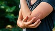 © master - Young Asian man itching and scratching on arm from allergic itchy dry skin eczema dermatitis insect bites  skin allergic concept, Woman itching on her arm have a red rash from allergy symptom