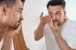 © Pixel-Shot - Young man putting in contact lenses near mirror at home, closeup