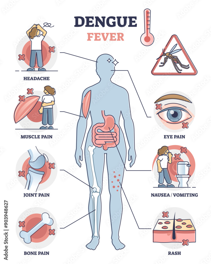 Denger Rash Dengue fever symptoms awareness poster, educational illustration ...