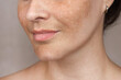 © Katyart - Close up caucasian woman's face with freckles or age spots photo. Age spots on the face