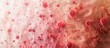 © meristock - Detailed view of eczema skin rash atopic dermatitis condition in a copy space image