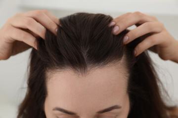 Wall Mural - Woman with hair loss problem at home, closeup