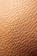 © fotogurmespb - Close-up of textured, dry human skin highlighting dermatological issues and skin health care concepts