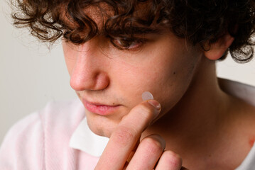 using acne pimple patch to clean the face from zits. young man uses acne stickers as bandage not to 