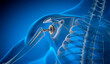 © peterschreiber.media - Shoulder joint replacement implant - X-ray view - Medically 3D illustration with blue background