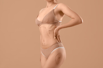 Poster - Young woman in underwear with marks on her body against beige background. Plastic surgery concept