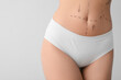 © Pixel-Shot - Young woman in underwear with marks on her abdomen against light background, closeup. Plastic surgery concept