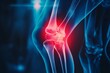 © Mikki Orso - 3d medical x ray of knee pain with arthritis inflammation and tendon injury, copy space