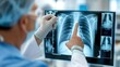© Pinklife - A doctor intently looks at a patient's chest X-ray displayed on a computer screen, pointing out important areas for diagnosis and treatment in a medical facility.