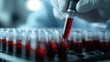 © Maximages  - A close-up shot of a gloved hand holding a pipette above rows of test tubes filled with blood, depicting a medical laboratory scene involving blood testing and analysis.