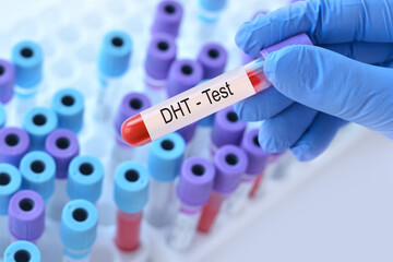 Wall Mural - Doctor holding a test blood sample tube with DHT hormone test on the background of medical test tubes with analyzes.