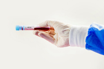 Mpox test samples in doctor hand with gloves. Diagnosis and laboratory. Studio shoot, white background.