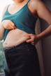 © ARMMY PICCA - fat woman, fat belly, chubby, obese woman hand holding excessive belly fat with measure tape, woman diet lifestyle concept