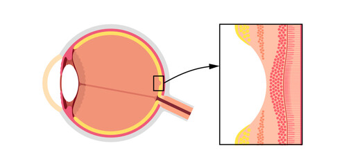 Wall Mural - Macula fovea and foveola