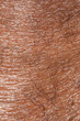 © Alessandro Grandini - Extreme close up showing dry skin texture and hair follicles on african man