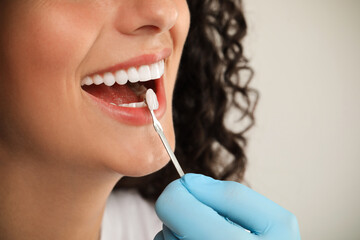 Sticker - Doctor checking young woman's teeth color on light grey background, closeup. Dental veneers