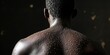 © AminaDesign - A detailed and closeup view of the back of a black individual, showcasing the monkeypox rash, which highlights the unique skin texture and condition associated with this skin ailment and disease