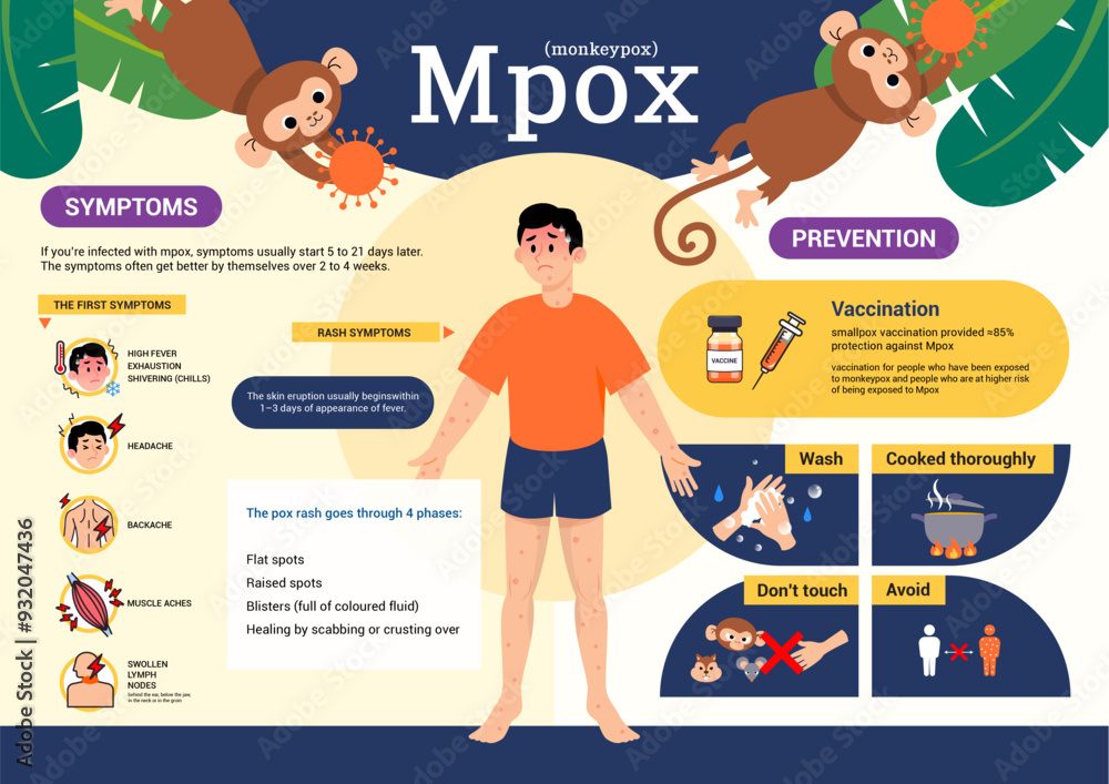 Mpox(Monkeypox) symptoms and prevention infographic poster vector ...
