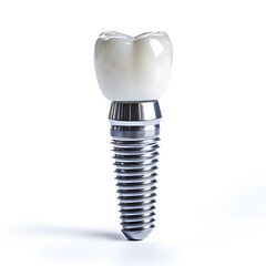 Wall Mural - Single Dental implant isolated on white background