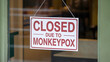© Art of Life - A sign reads 'Closed Due to Monkeypox' with the text prominently displayed in red on a white background.