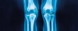 © Oatkhaphon - X-ray image of human knees showing joint structure and alignment, useful for medical analysis and educational purposes.