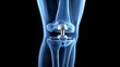 © Four888 - X-ray of artificial knee joint implant in human leg, showing metallic prosthesis and bone integration, with surrounding tissue and ligaments for medical illustration.