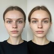 © Business Image - Before and after images of a model showcasing the effects of skincare treatment with creme and lotion.