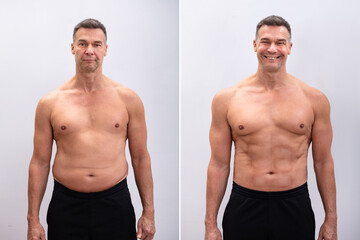 Mature Man Before And After Weight Loss On White Background