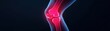 © Khritthithat - Knee joint, common sports injuries, 3D illustration