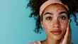 © Emilio - Young african american woman with acne embracing self-love for Acne Positivity Day. Highlighting confidence, body positivity, and acceptance of skin imperfections photo with copy space