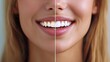 © K-MookPan - A close-up of a woman's face showing a radiant smile, highlighting healthy teeth and vibrant skin for beauty and dental topics.