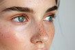 © Vilma - close up portrait of a woman skin with freckles, beautiful eyes
