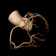 © clsdesign - CT image of a heart coronary tree isolated on black