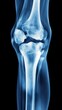 © Iswanto - X-ray image of a human knee joint, showing the bones and ligaments.