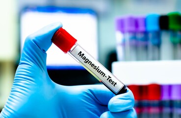 Blood sample tube for magnesium test analysis.