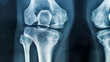 © Muhammad - X ray anatomy and healthcare or knee on film body injury and skeleton and medical for radiology, X-ray anatomy, knee X-ray, radiology image, body injury, skeletal X-ray, medical imaging