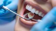 © Arieswanto - Close-up of Teeth Examination with Dental Mirror