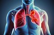 © Michael - Comprehensive Overview of Lung Cancer and Associated Diseases in Healthcare Settings